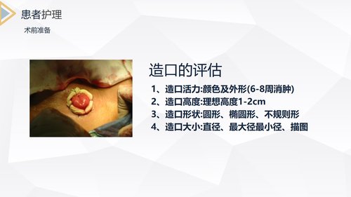 a0213 结肠癌直肠癌护理PPT课件69页可编辑无水印直接可用 第16页