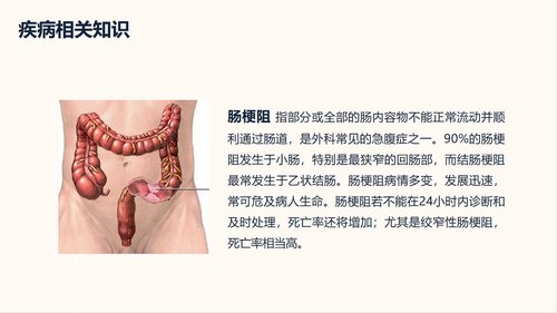 a0215 肠梗阻护理查房PPT课件32页可编辑无水印直接可用 第3页