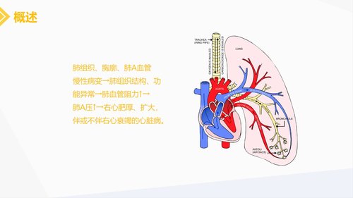 a0216 肺源性心脏病病人的护理PPT课件30页可编辑无水印直接可用 第3页