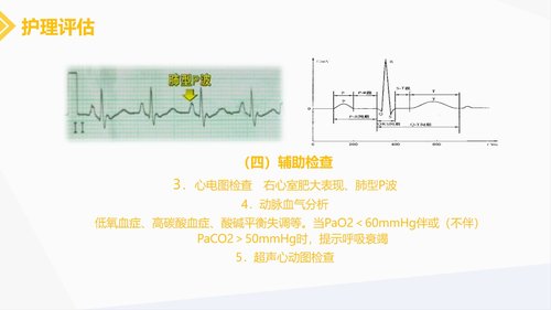 a0216 肺源性心脏病病人的护理PPT课件30页可编辑无水印直接可用 第12页