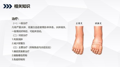 a0219 肾病综合症的护理查房知识课件PPT课件44页可编辑无水印直接可用 第19页