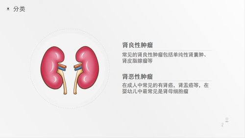 a0220 肾肿瘤护理查房综合新课件PPT课件41页可编辑无水印直接可用 第4页