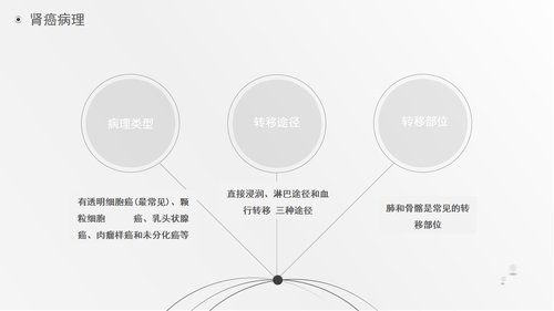 a0220 肾肿瘤护理查房综合新课件PPT课件41页可编辑无水印直接可用 第6页
