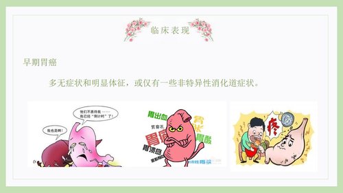 a0221 胃癌病人的护理医院讲解PPT课件PPT课件17页可编辑无水印直接可用 第6页