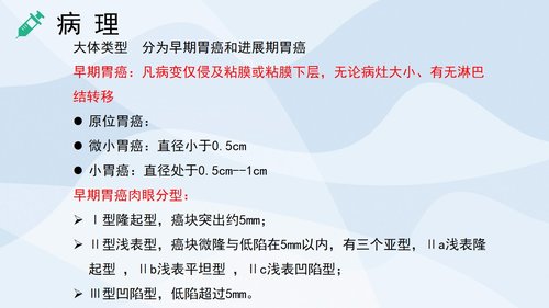 a0224 胃癌的护理查房2PPT课件30页可编辑无水印直接可用 第3页