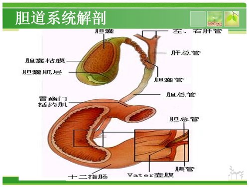 a0226 胆总管结石护理查房PPT课件43页可编辑无水印直接可用 第3页