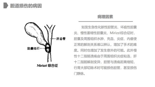 a0228 胆道损伤的护理措施知识课件PPT课件28页可编辑无水印直接可用 第4页
