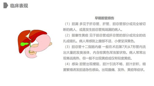 a0228 胆道损伤的护理措施知识课件PPT课件28页可编辑无水印直接可用 第6页