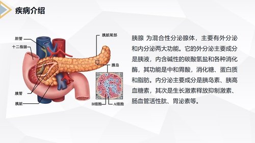 a0229 胰腺癌患者护理查房PPT课件40页可编辑无水印直接可用 第3页