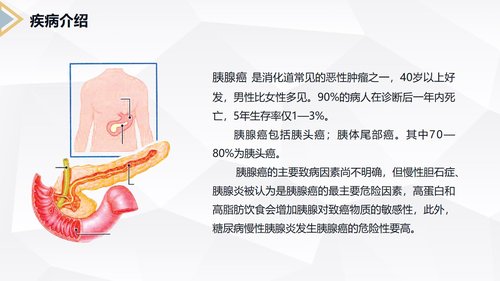 a0229 胰腺癌患者护理查房PPT课件40页可编辑无水印直接可用 第4页