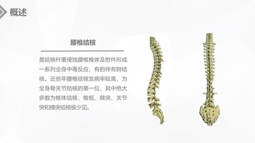 a0234 腰椎结核的手术期护理课件PPT课件20页可编辑无水印直接可用 第4页