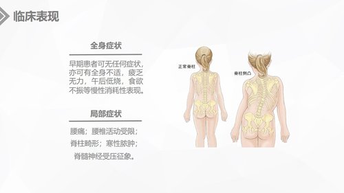 a0234 腰椎结核的手术期护理课件PPT课件20页可编辑无水印直接可用 第5页