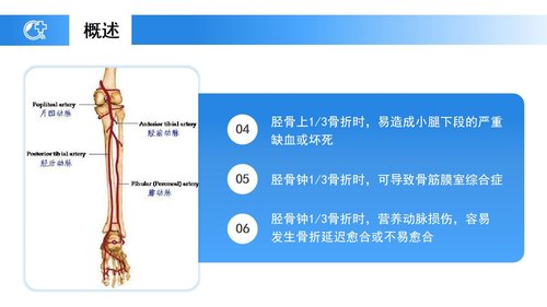 a0238 蓝色医疗模板-胫腓骨骨折护理PPT课件23页可编辑无水印直接可用 第5页