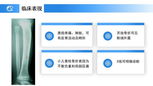 a0238 蓝色医疗模板-胫腓骨骨折护理PPT课件23页可编辑无水印直接可用 第7页