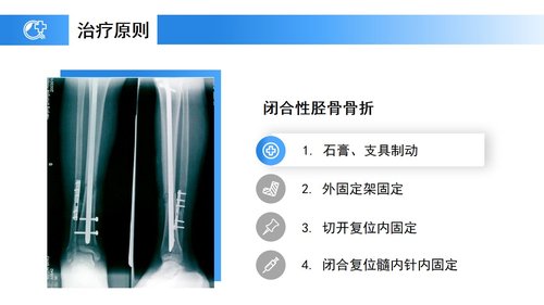 a0238 蓝色医疗模板-胫腓骨骨折护理PPT课件23页可编辑无水印直接可用 第9页