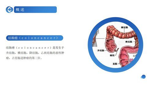 a0239 蓝色简约风结肠癌病人护理查房PPPPT课件23页可编辑无水印直接可用 第4页