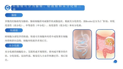 a0239 蓝色简约风结肠癌病人护理查房PPPPT课件23页可编辑无水印直接可用 第9页