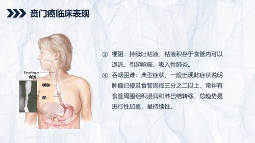 a0240 贲门癌伴脓胸吻合口瘘护理查房PPT课件43页可编辑无水印直接可用 第6页