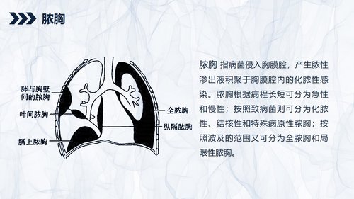 a0240 贲门癌伴脓胸吻合口瘘护理查房PPT课件43页可编辑无水印直接可用 第7页