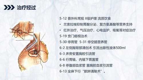 a0240 贲门癌伴脓胸吻合口瘘护理查房PPT课件43页可编辑无水印直接可用 第11页