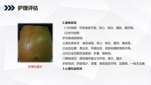 a0242 酒精性肝硬化护理教学查房PPT课件36页可编辑无水印直接可用 第10页