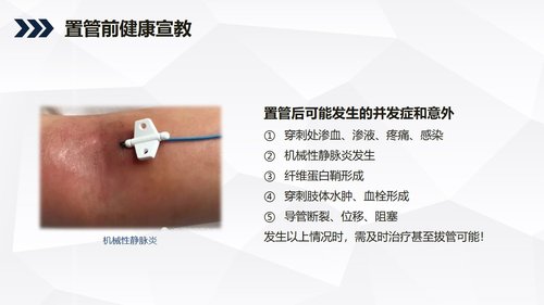 a0242 酒精性肝硬化护理教学查房PPT课件36页可编辑无水印直接可用 第17页