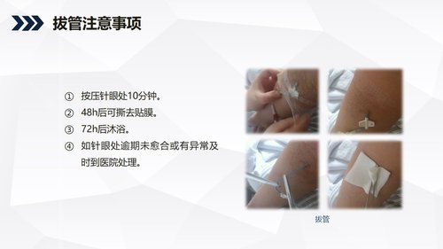 a0242 酒精性肝硬化护理教学查房PPT课件36页可编辑无水印直接可用 第18页