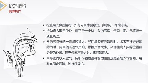 a0243 重症肌无力（Ⅲ型）护理查房PPT课件28页可编辑无水印直接可用 第18页