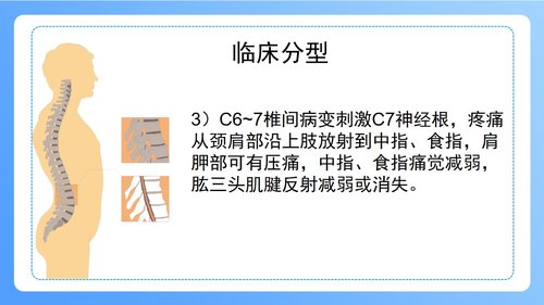 a0247 颈椎病病人的护理PPT课件47页可编辑无水印直接可用 第5页