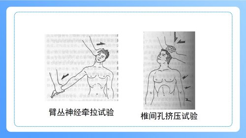 a0247 颈椎病病人的护理PPT课件47页可编辑无水印直接可用 第18页