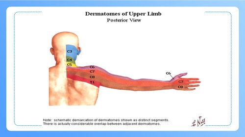 a0247 颈椎病病人的护理PPT课件47页可编辑无水印直接可用 第19页