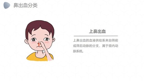 a0249 鼻出血护理诊断措施业务PPT课件27页可编辑无水印直接可用 第3页