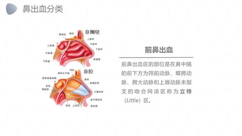 a0249 鼻出血护理诊断措施业务PPT课件27页可编辑无水印直接可用 第5页