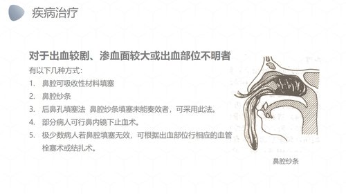 a0249 鼻出血护理诊断措施业务PPT课件27页可编辑无水印直接可用 第12页