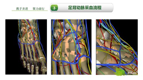 a0259 动脉血气分析临床操作实践标准PPT(40张)【41页】PPT课件41页可编辑无水印直接可用 第15页