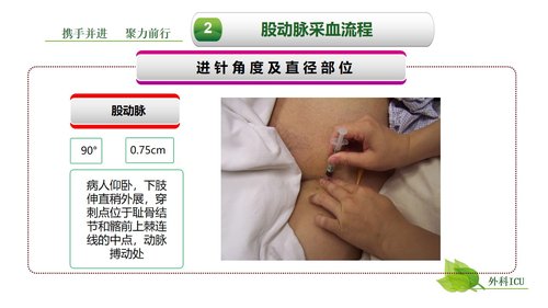 a0259 动脉血气分析临床操作实践标准PPT(40张)【41页】PPT课件41页可编辑无水印直接可用 第16页
