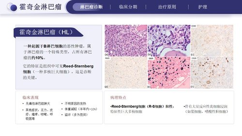 a0275 淋巴瘤的治疗与护理PPT课件33页可编辑无水印直接可用 第7页