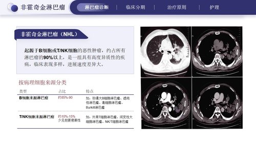 a0275 淋巴瘤的治疗与护理PPT课件33页可编辑无水印直接可用 第9页