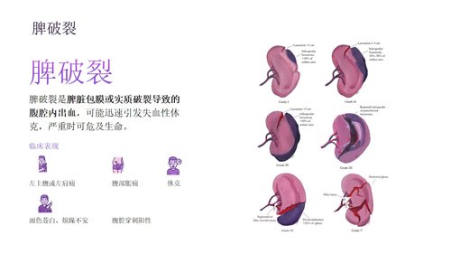 a0277 脾破裂患者的护理PPT课件33页可编辑无水印直接可用 第7页