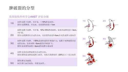 a0277 脾破裂患者的护理PPT课件33页可编辑无水印直接可用 第9页