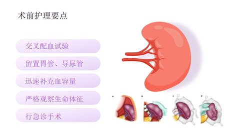a0277 脾破裂患者的护理PPT课件33页可编辑无水印直接可用 第13页