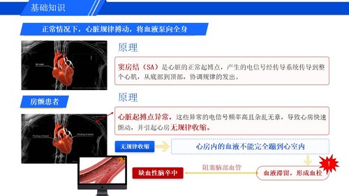 a0278 认识心房颤动PPT课件16页可编辑无水印直接可用 第9页