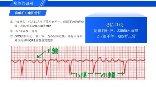 a0278 认识心房颤动PPT课件16页可编辑无水印直接可用 第13页