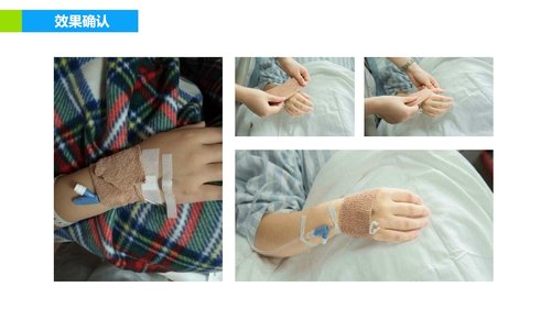 a0293 品管圈医疗QC模版PPTPPT课件36页可编辑无水印直接可用 第16页