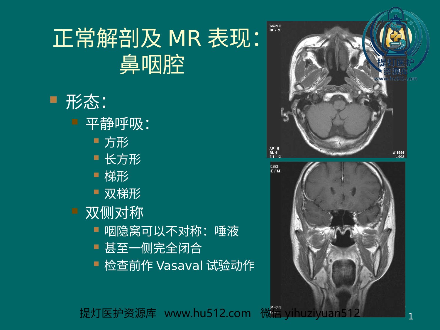 a00602 鼻咽癌MR诊断2018 20页PPT文档可编辑无水印直接可用