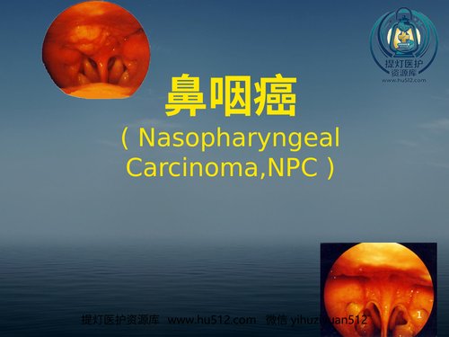 a00683 本科生鼻咽癌讲课幻灯PPT教学课件 20页PPT文档可编辑无水印直接可用