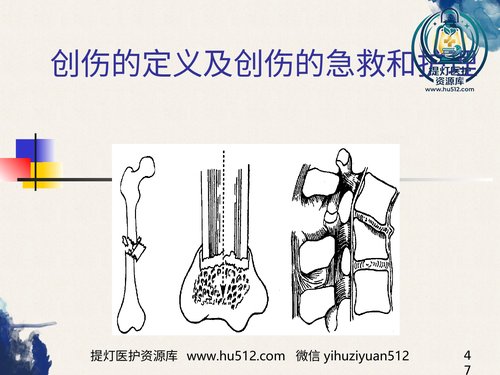 a01187 创伤的定义及创伤的急救和护理 20页PPT文档可编辑无水印直接可用