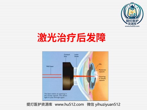 a01234 激光治疗后发性白内障 20页PPT文档可编辑无水印直接可用