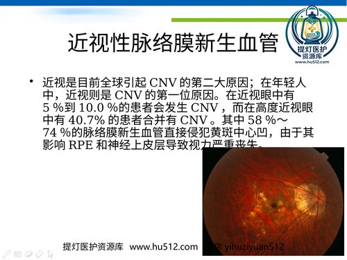 a01242 高度近视黄斑新生血管改汇总 20页PPT文档可编辑无水印直接可用