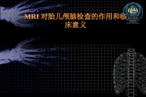a01480 MRI对胎儿颅脑检查的作用和临床意义ppt课件 77页PPT课件可编辑无水印直接可用